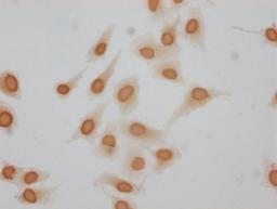 Immunocytochemistry analysis of CSB-PA010380OA62forHU diluted at 1:10 and staining in Hela cells(treated with 30mM sodium butyrate for 4h) performed on a Leica BondTM system. The cells were fixed in 4% formaldehyde, permeabilized using 0.2% Triton X-100 and blocked with 10% normal goat serum 30min at RT. Then primary antibody (1% BSA) was incubated at 4°C overnight. The primary is detected by a biotinylated secondary antibody and visualized using an HRP conjugated SP system.