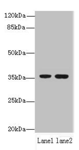Western blot. All lanes: EEF2KMT antibody at 6µg/ml. Lane 1: Hela whole cell lysate. Lane 2: 293T whole cell lysate. Secondary. Goat polyclonal to rabbit IgG at 1/10000 dilution. Predicted band size: 37, 34 kDa. Observed band size: 37 kDa