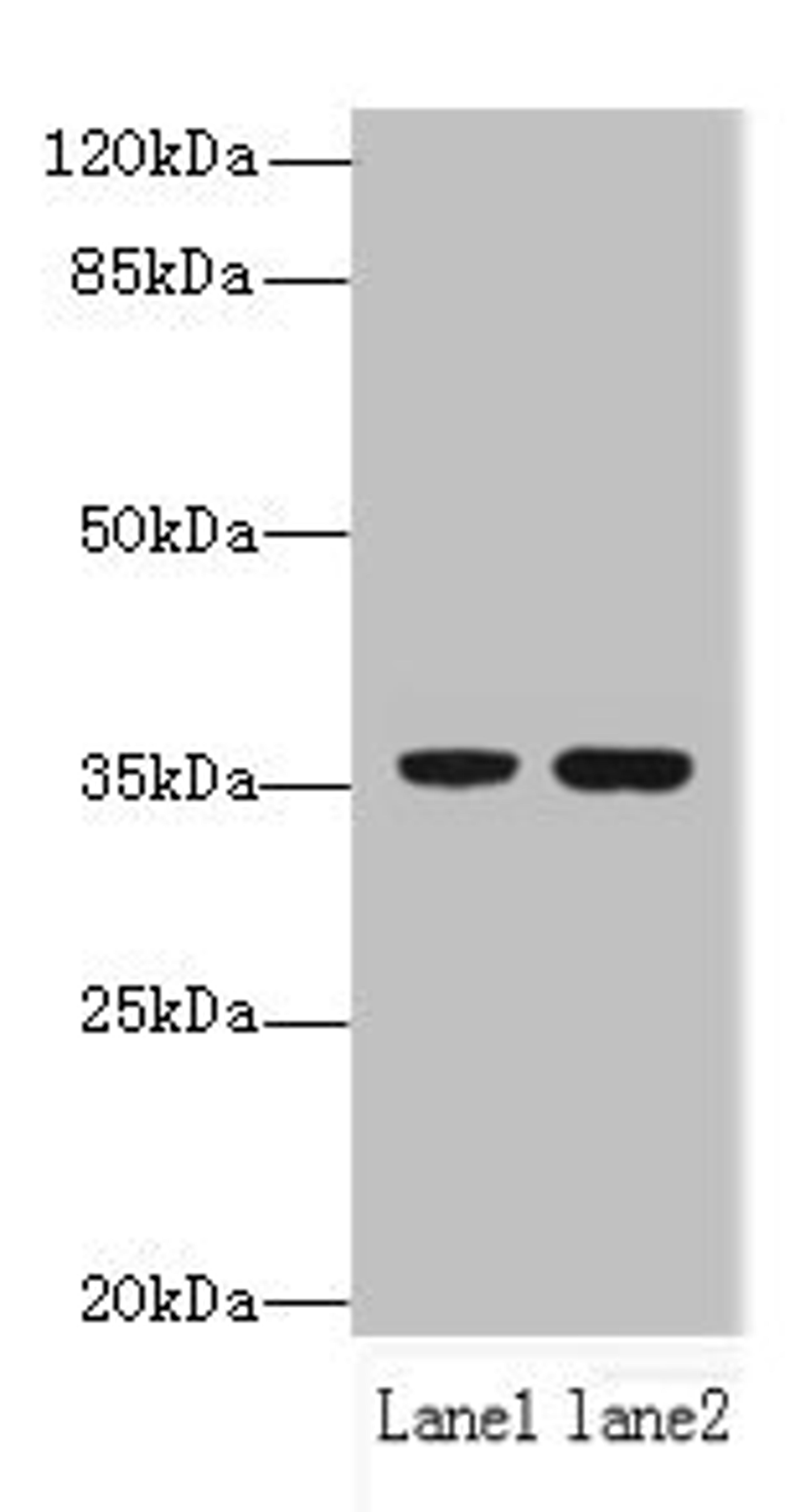Western blot. All lanes: EEF2KMT antibody at 6µg/ml. Lane 1: Hela whole cell lysate. Lane 2: 293T whole cell lysate. Secondary. Goat polyclonal to rabbit IgG at 1/10000 dilution. Predicted band size: 37, 34 kDa. Observed band size: 37 kDa