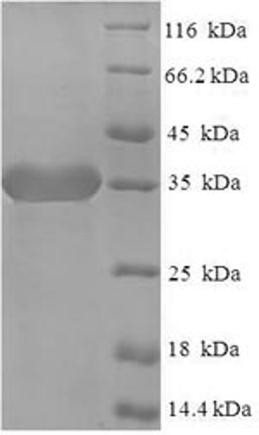 (Tris-Glycine gel) Discontinuous SDS-PAGE (reduced) with 5% enrichment gel and 15% separation gel.