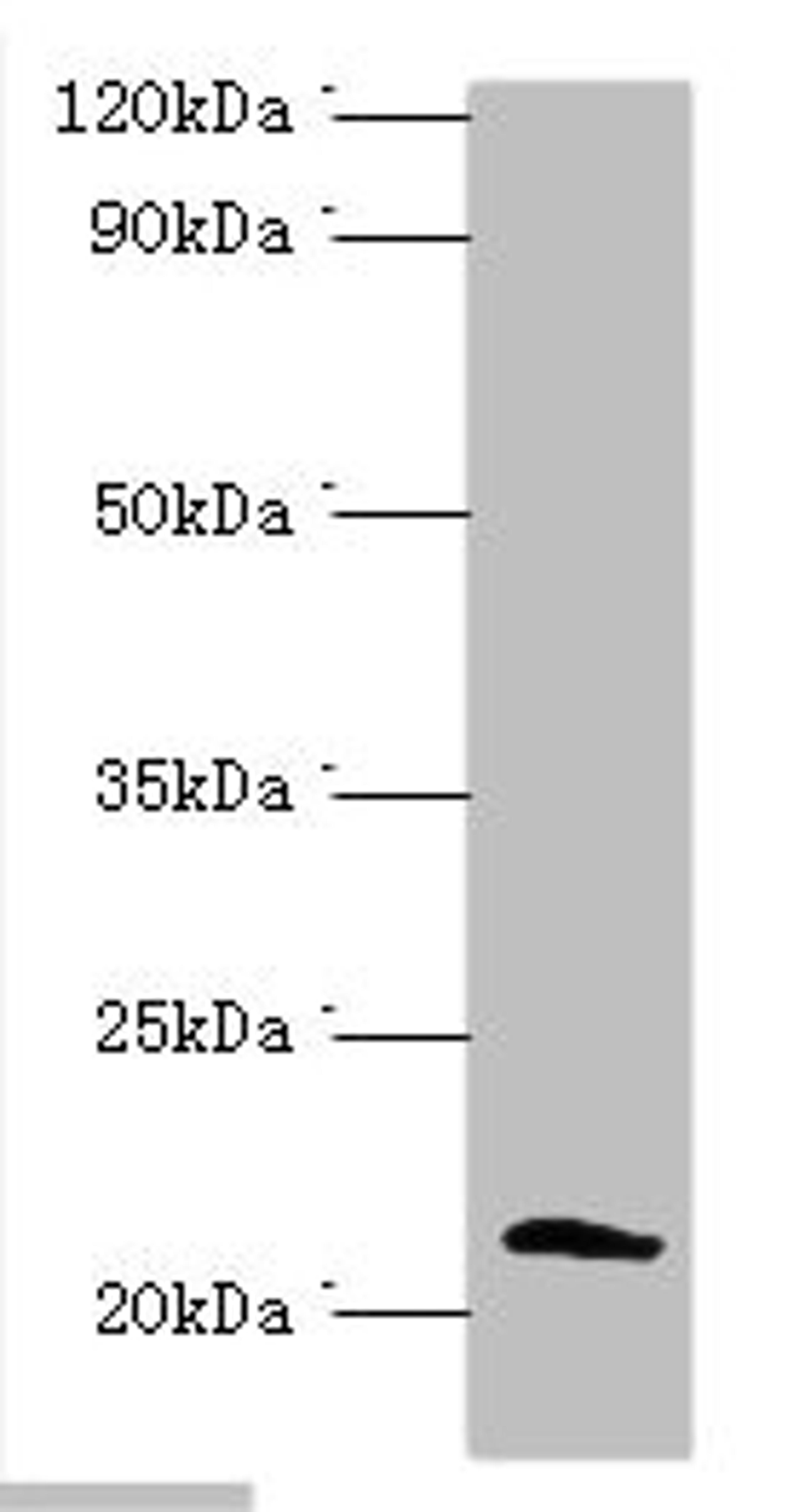 Western blot. All lanes: Protein SSX2 antibody at 2ug/ml + MDA-MB-231 whole cell lysate. Secondary. Goat polyclonal to rabbit IgG at 1/10000 dilution. Predicted band size: 22, 26 kDa. Observed band size: 22 kDa. 