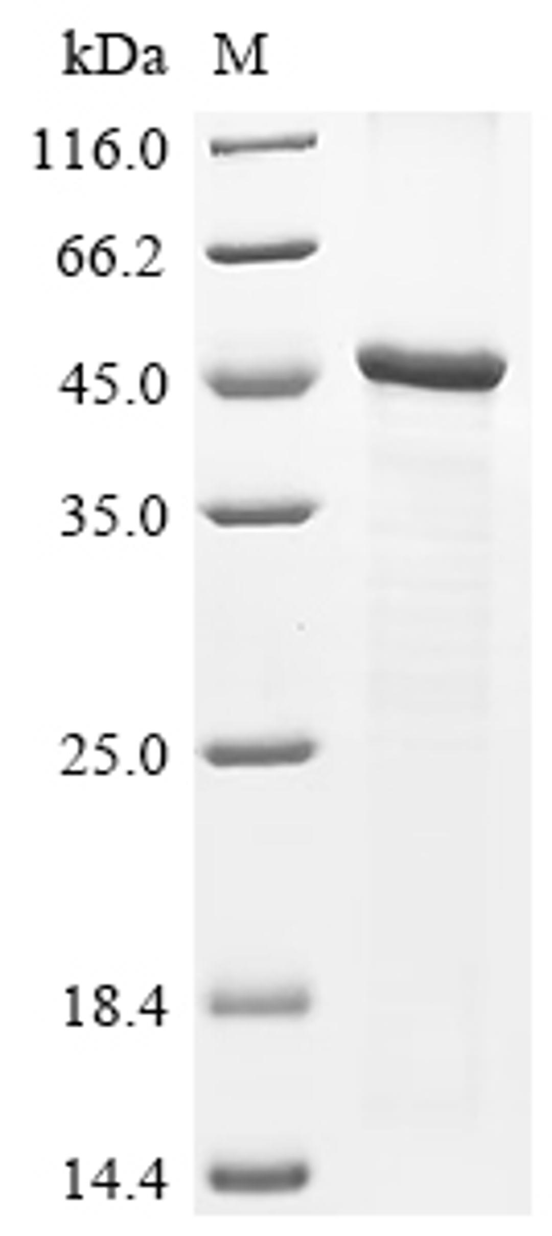 (Tris-Glycine gel) Discontinuous SDS-PAGE (reduced) with 5% enrichment gel and 15% separation gel.