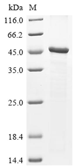 (Tris-Glycine gel) Discontinuous SDS-PAGE (reduced) with 5% enrichment gel and 15% separation gel.