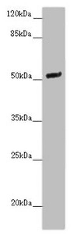 Western blot. All lanes: NOXA1 antibody at 2 ug/ml + Mouse brain tissue. Secondary. Goat polyclonal to rabbit IgG at 1/10000 dilution. Predicted band size: 51, 52, 46 kDa. Observed band size: 51 kDa. 