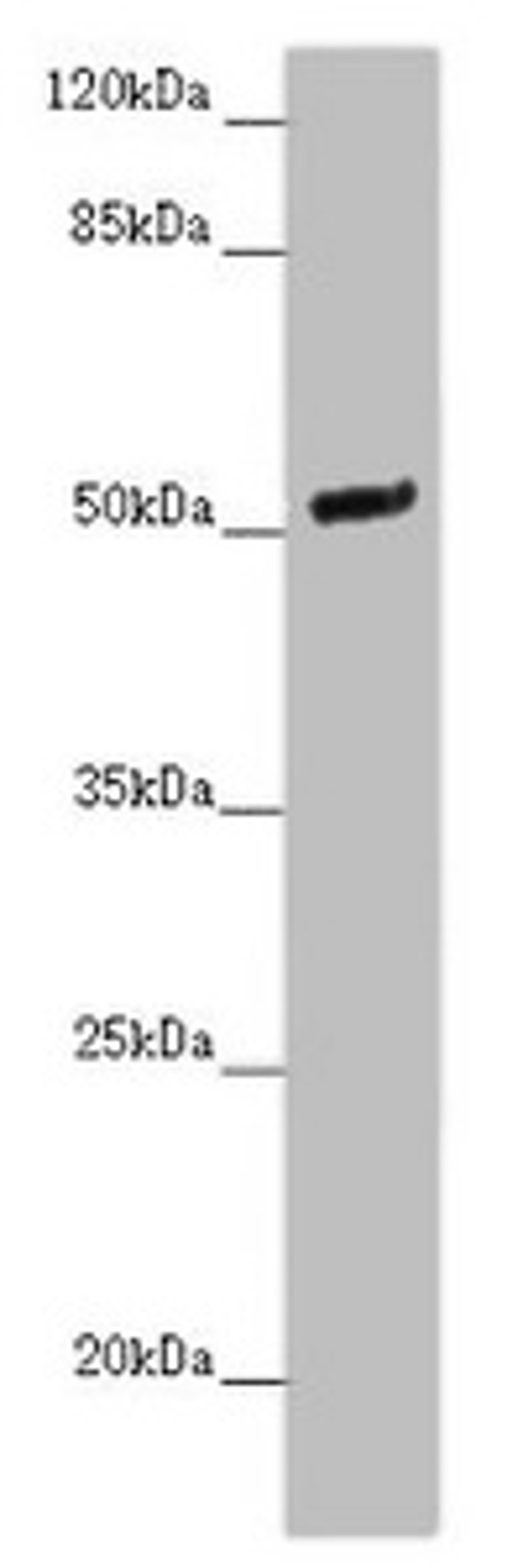 Western blot. All lanes: NOXA1 antibody at 2 ug/ml + Mouse brain tissue. Secondary. Goat polyclonal to rabbit IgG at 1/10000 dilution. Predicted band size: 51, 52, 46 kDa. Observed band size: 51 kDa. 