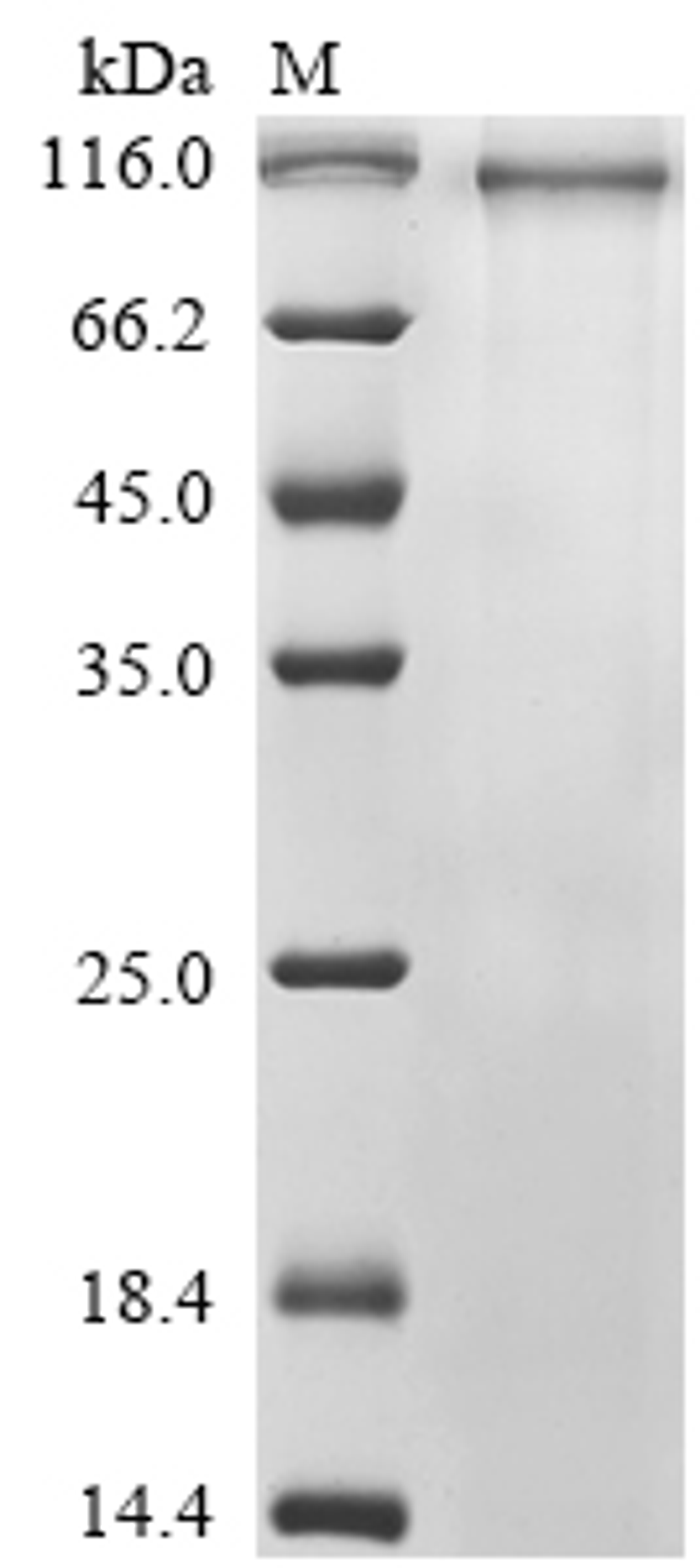 (Tris-Glycine gel) Discontinuous SDS-PAGE (reduced) with 5% enrichment gel and 15% separation gel.