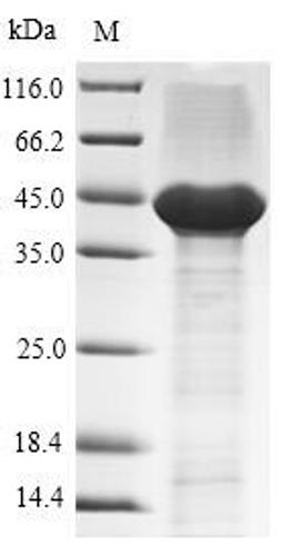 (Tris-Glycine gel) Discontinuous SDS-PAGE (reduced) with 5% enrichment gel and 15% separation gel.