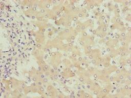 Immunohistochemistry of paraffin-embedded human liver tissue using CSB-PA008750LA01HU at dilution of 1:100