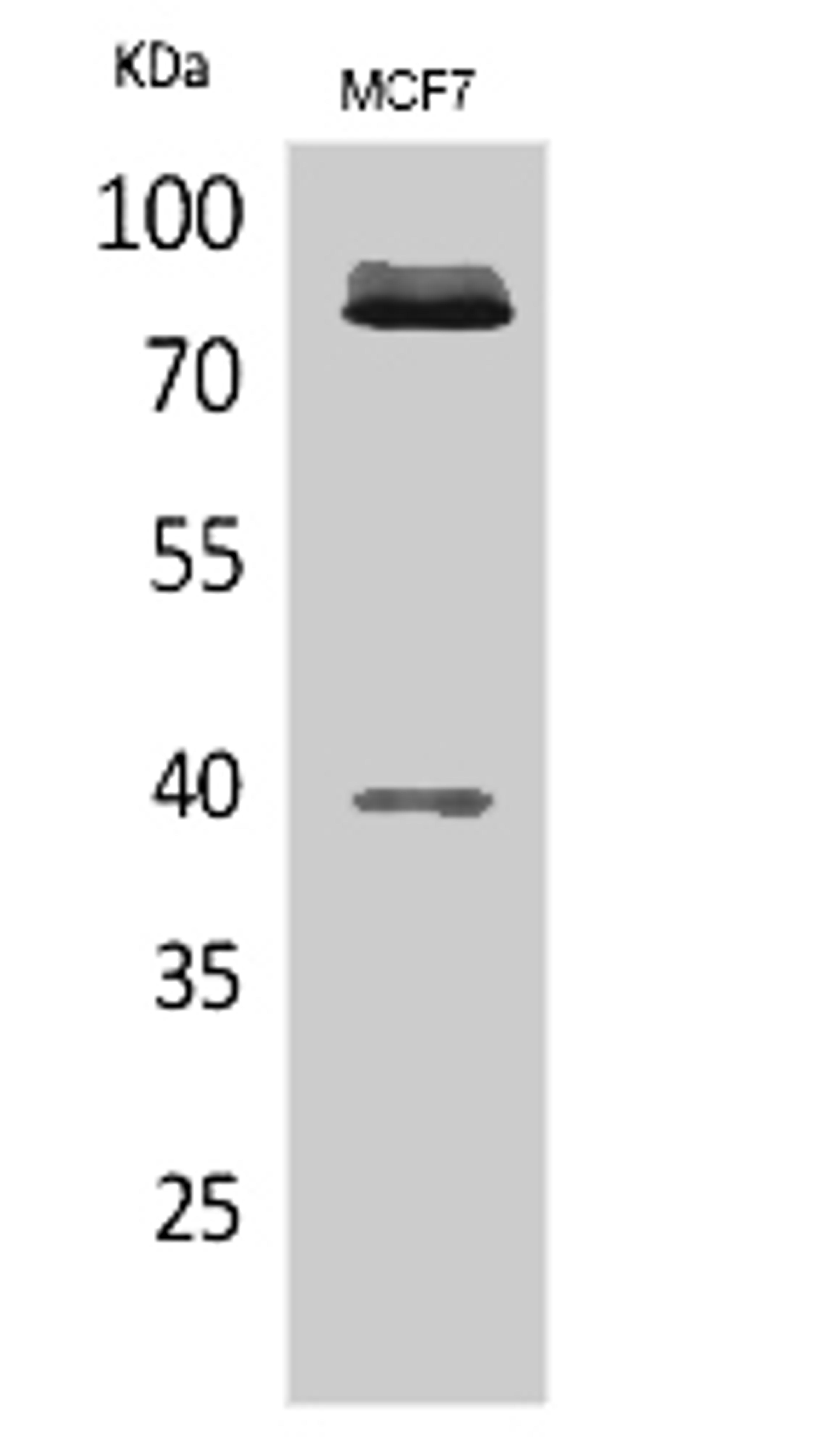 Western blot. All lanes: IL1R1 antibody at 6µg/ml. Lane 1: Hela whole cell lysate. Lane 2: Mouse heart tissue. Secondary. Goat polyclonal to rabbit IgG at 1/10000 dilution. Predicted band size: 65 kDa. Observed band size: 65 kDa