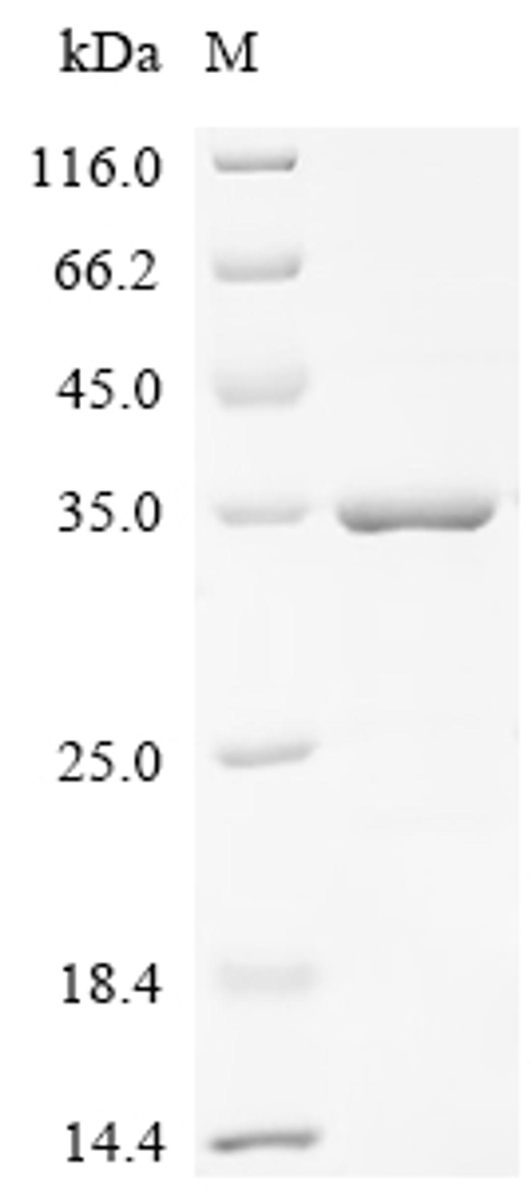 (Tris-Glycine gel) Discontinuous SDS-PAGE (reduced) with 5% enrichment gel and 15% separation gel.