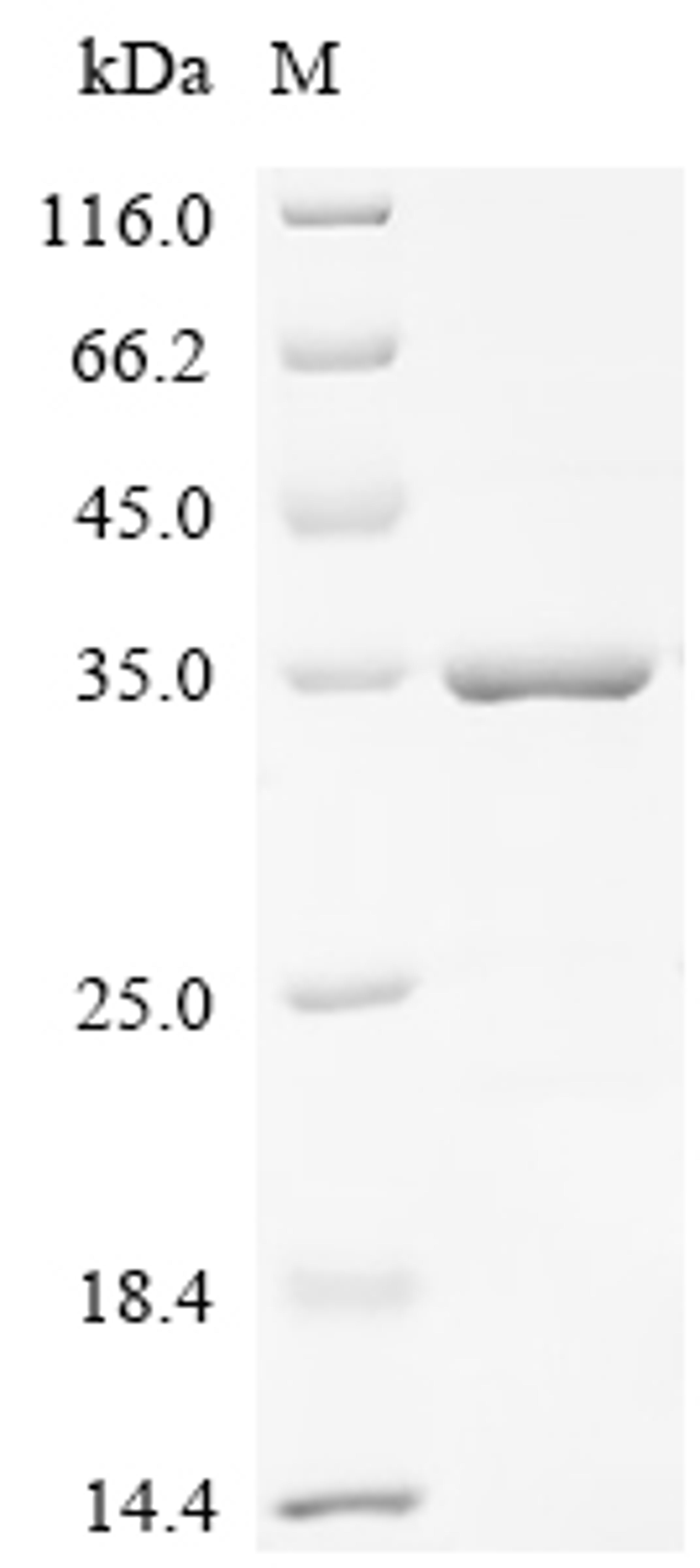 (Tris-Glycine gel) Discontinuous SDS-PAGE (reduced) with 5% enrichment gel and 15% separation gel.