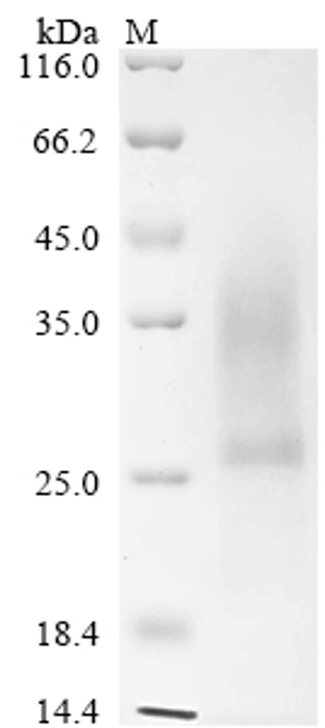 (Tris-Glycine gel) Discontinuous SDS-PAGE (reduced) with 5% enrichment gel and 15% separation gel.