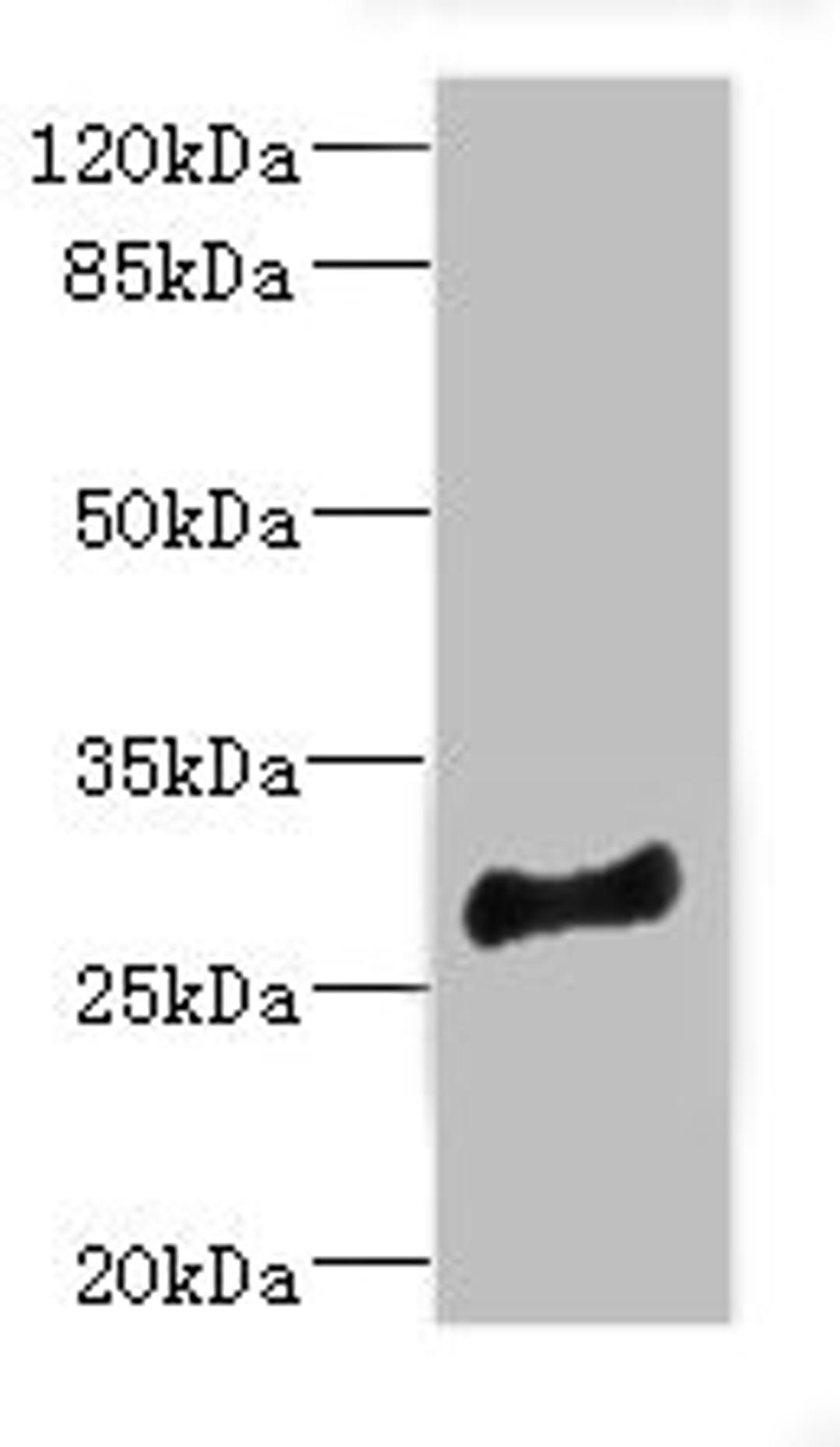 Western blot. All lanes: MLF1 antibody at 4.05ug/ml + Mouse brain tissue. Secondary. Goat polyclonal to rabbit IgG at 1/10000 dilution. Predicted band size: 31, 24, 34, 28, 30 kDa. Observed band size: 31 kDa. 