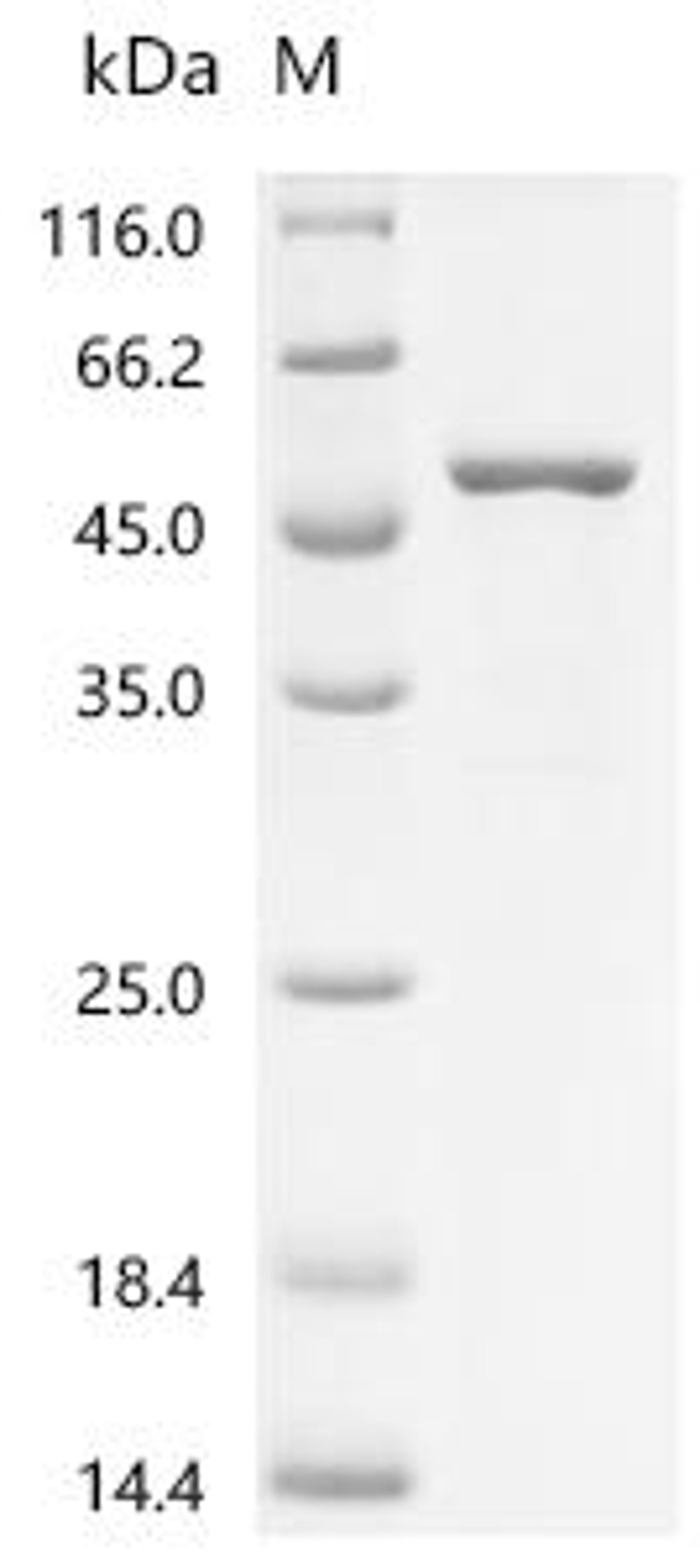 (Tris-Glycine gel) Discontinuous SDS-PAGE (reduced) with 5% enrichment gel and 15% separation gel.