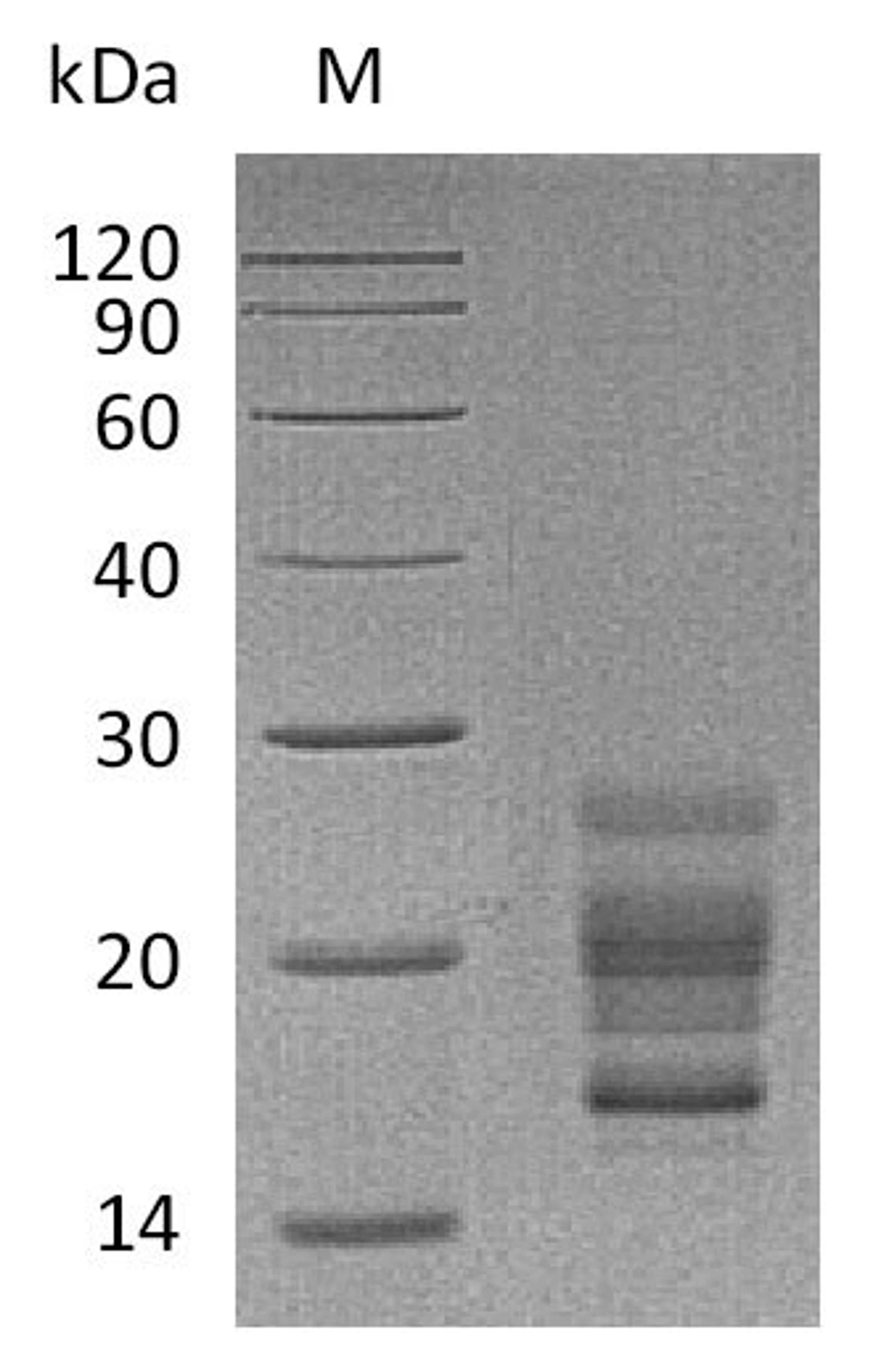 (Tris-Glycine gel) Discontinuous SDS-PAGE (reduced) with 5% enrichment gel and 15% separation gel.