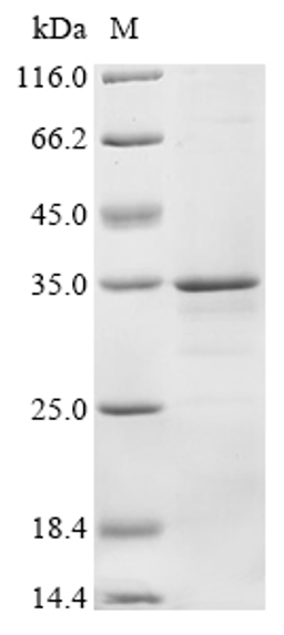 (Tris-Glycine gel) Discontinuous SDS-PAGE (reduced) with 5% enrichment gel and 15% separation gel.
