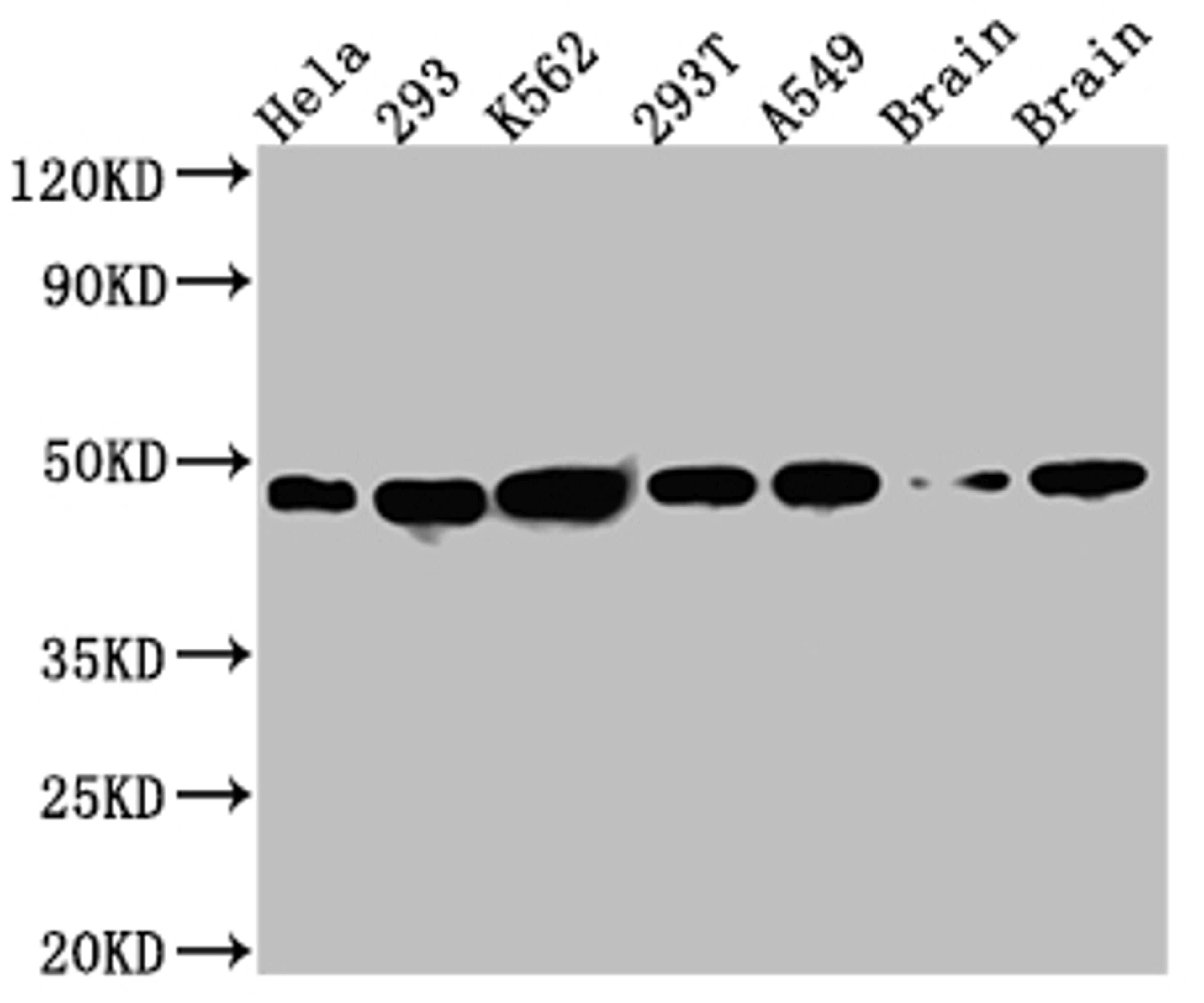 Western Blot. Positive WB detected in: Hela whole cell lysate, 293 whole cell lysate, K562 whole cell lysate, 293T whole cell lysate, A549 whole cell lysate, Rat Brain whole cell lysate, Mouse Brain whole cell lysate. All lanes: NUDC antibody at 1:1000. Secondary. Goat polyclonal to rabbit IgG at 1/50000 dilution. Predicted band size: 39 kDa. Observed band size: 45 kDa. 