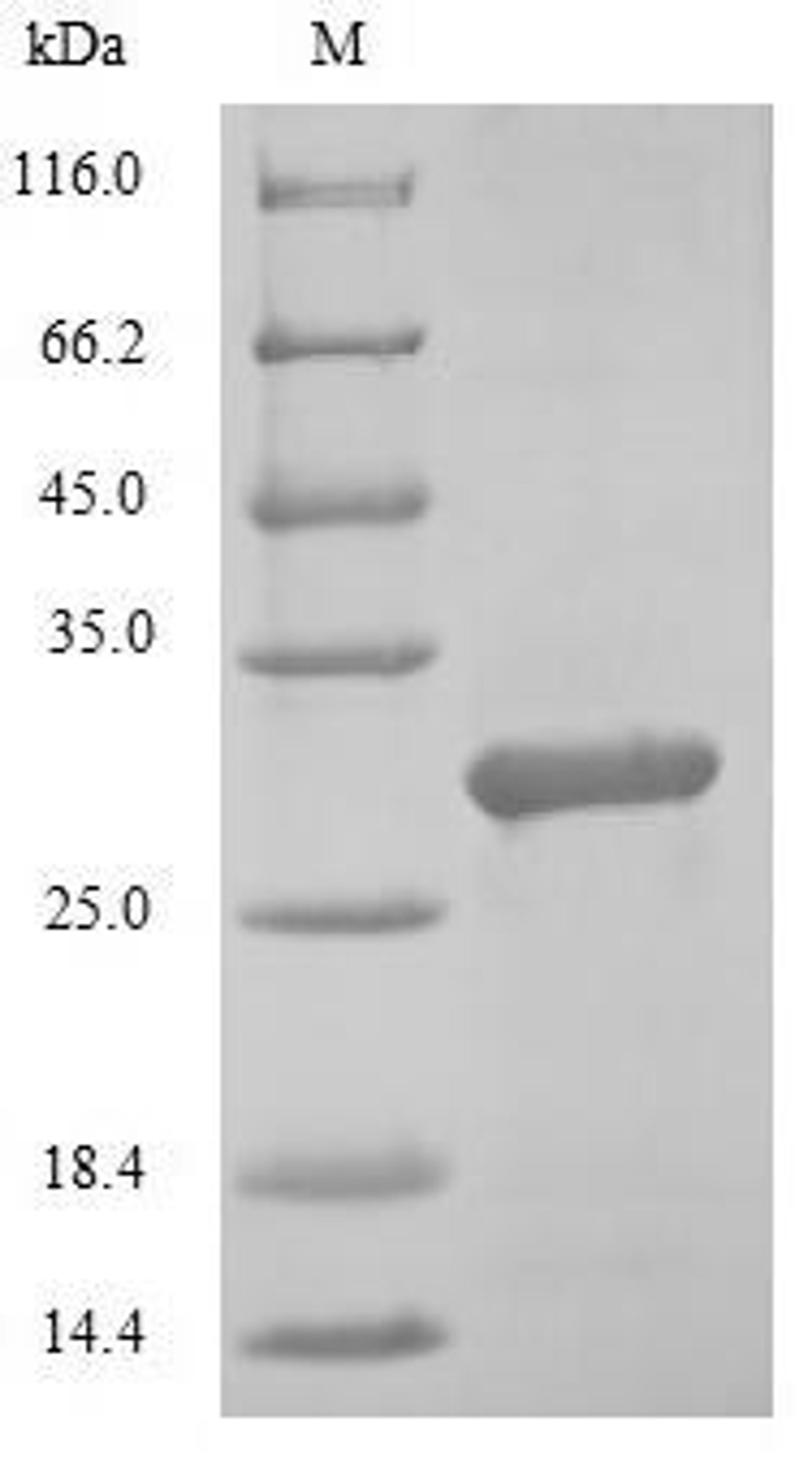 (Tris-Glycine gel) Discontinuous SDS-PAGE (reduced) with 5% enrichment gel and 15% separation gel.