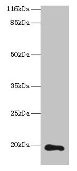 Western blot. All lanes: RAB30 antibody at 1µg/ml + Hela whole cell lysate. Secondary. Goat polyclonal to rabbit IgG at 1/10000 dilution. Predicted band size: 24, 19 kDa. Observed band size: 19 kDa