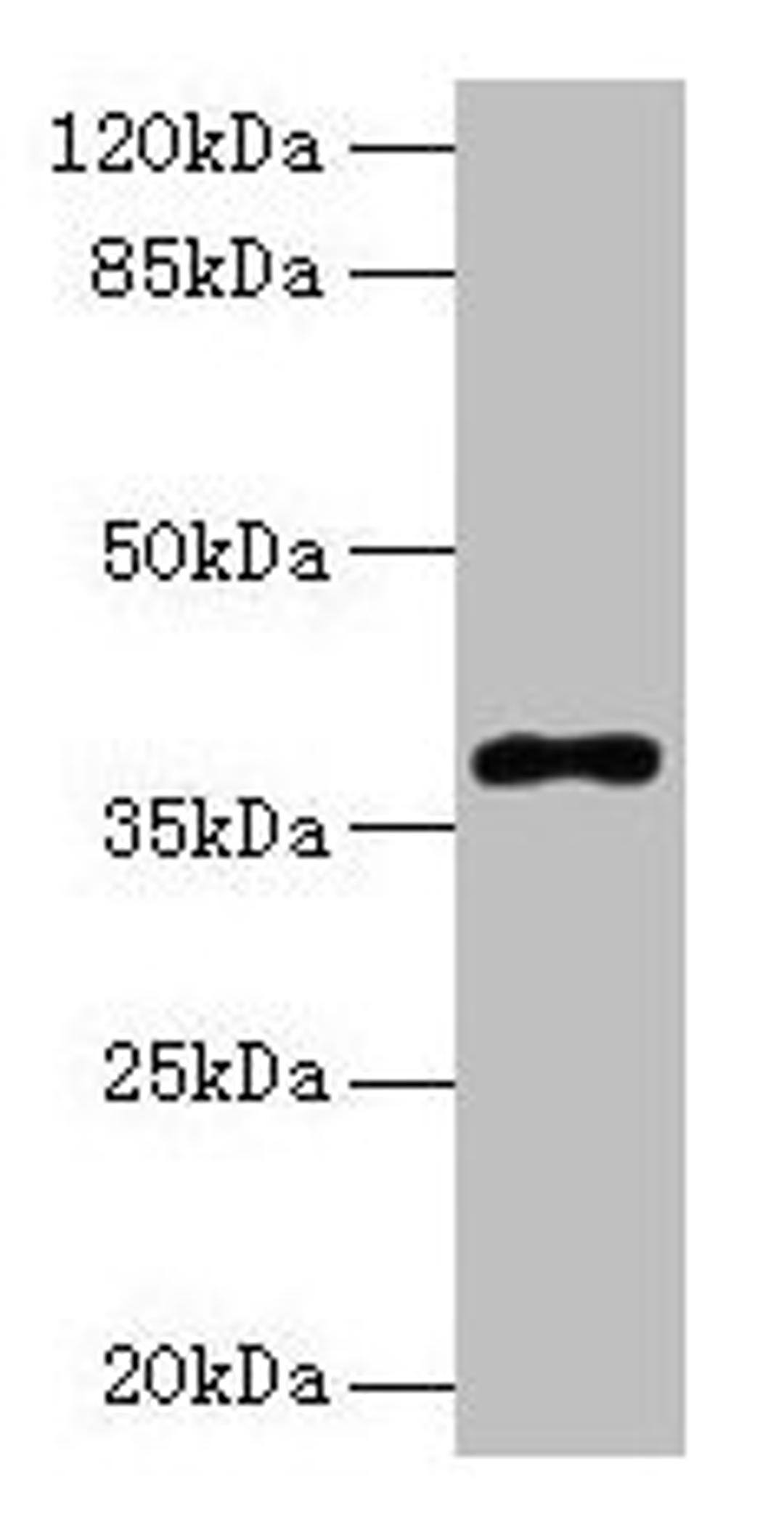 Western blot. All lanes: POLB antibody at 8µg/ml + Colo320 whole cell lysate. Secondary. Goat polyclonal to rabbit IgG at 1/10000 dilution. Predicted band size: 39 kDa. Observed band size: 39 kDa