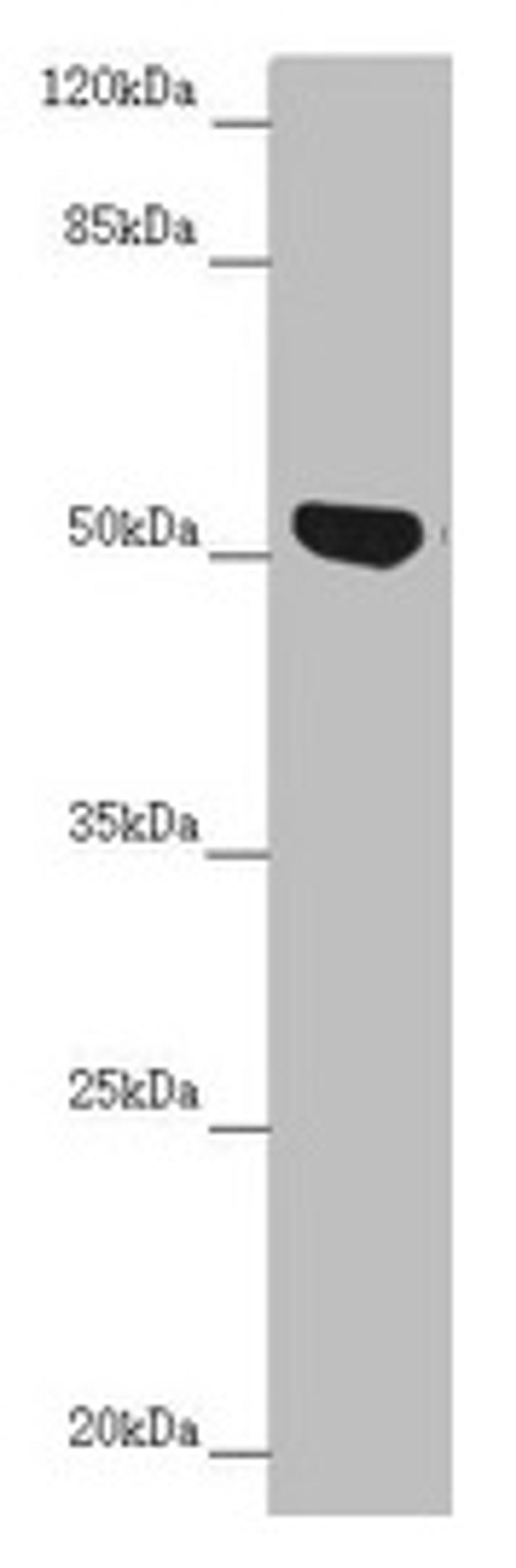 Western blot. All lanes: NUF2 antibody at 5.29µg/ml + Jurkat whole cell lysate. Secondary. Goat polyclonal to rabbit IgG at 1/10000 dilution. Predicted band size: 54 kDa. Observed band size: 54 kDa