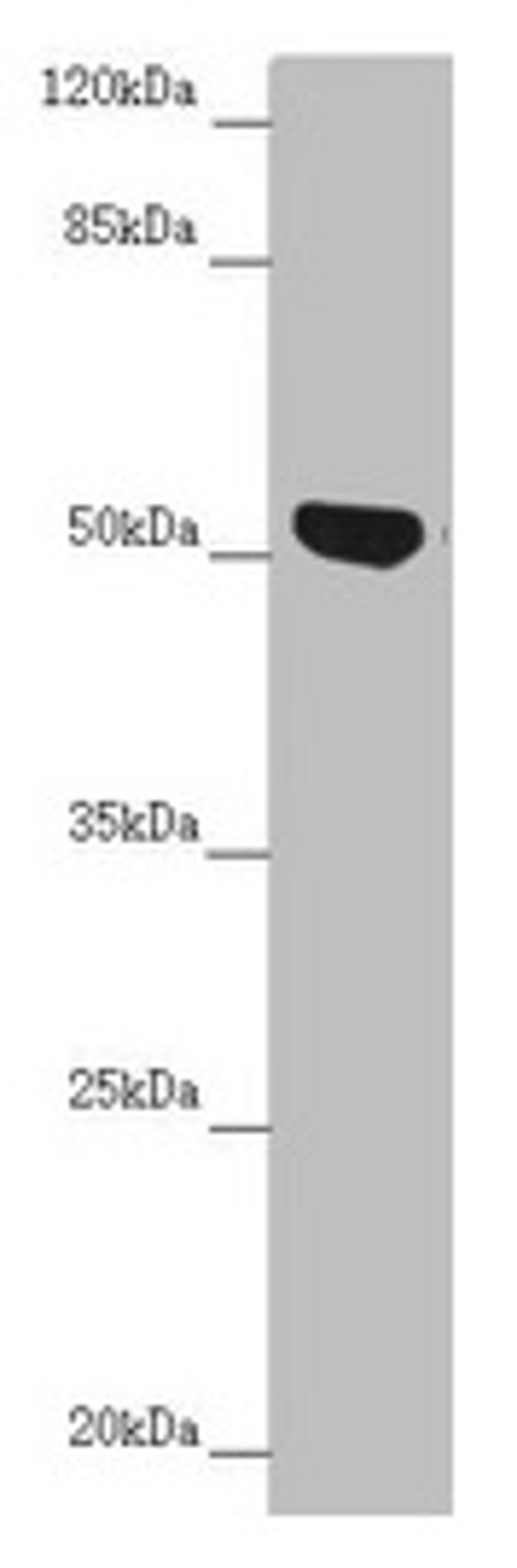 Western blot. All lanes: NUF2 antibody at 5.29µg/ml + Jurkat whole cell lysate. Secondary. Goat polyclonal to rabbit IgG at 1/10000 dilution. Predicted band size: 54 kDa. Observed band size: 54 kDa