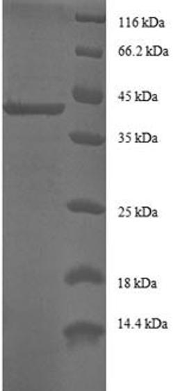 (Tris-Glycine gel) Discontinuous SDS-PAGE (reduced) with 5% enrichment gel and 15% separation gel.