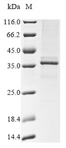 (Tris-Glycine gel) Discontinuous SDS-PAGE (reduced) with 5% enrichment gel and 15% separation gel.