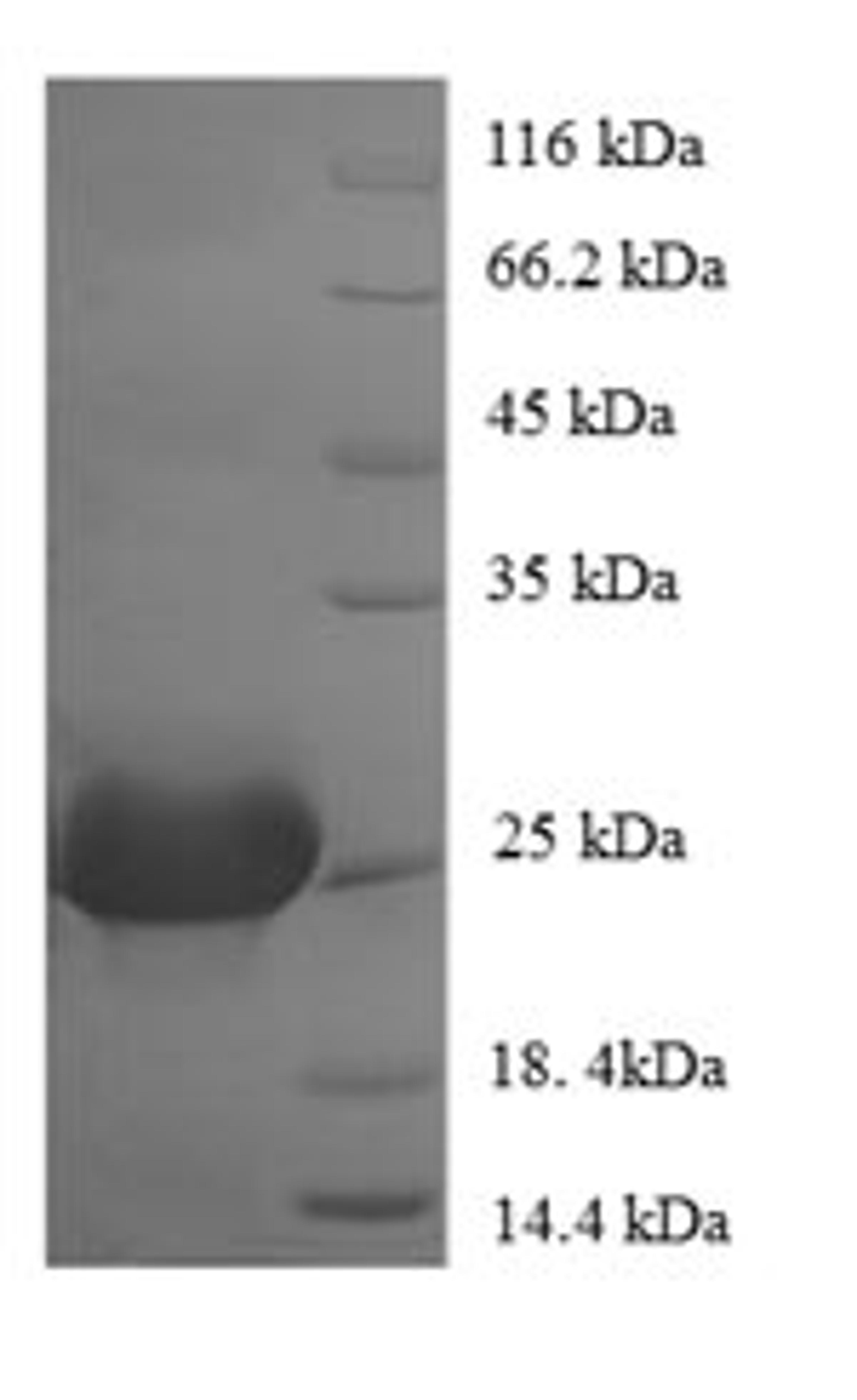 (Tris-Glycine gel) Discontinuous SDS-PAGE (reduced) with 5% enrichment gel and 15% separation gel.