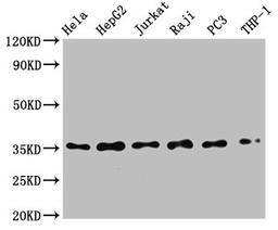 Western Blot. Positive WB detected in: Hela whole cell lysate, HepG2 whole cell lysate, Jurkat whole cell lysate, Raji whole cell lysate, PC3 whole cell lysate, THP-1 whole cell lysate. All lanes: NFKBIA antibody at 0.79μg/ml. Secondary. Goat polyclonal to rabbit IgG at 1/50000 dilution. Predicted band size: 36 KDa. Observed band size: 36 KDa.