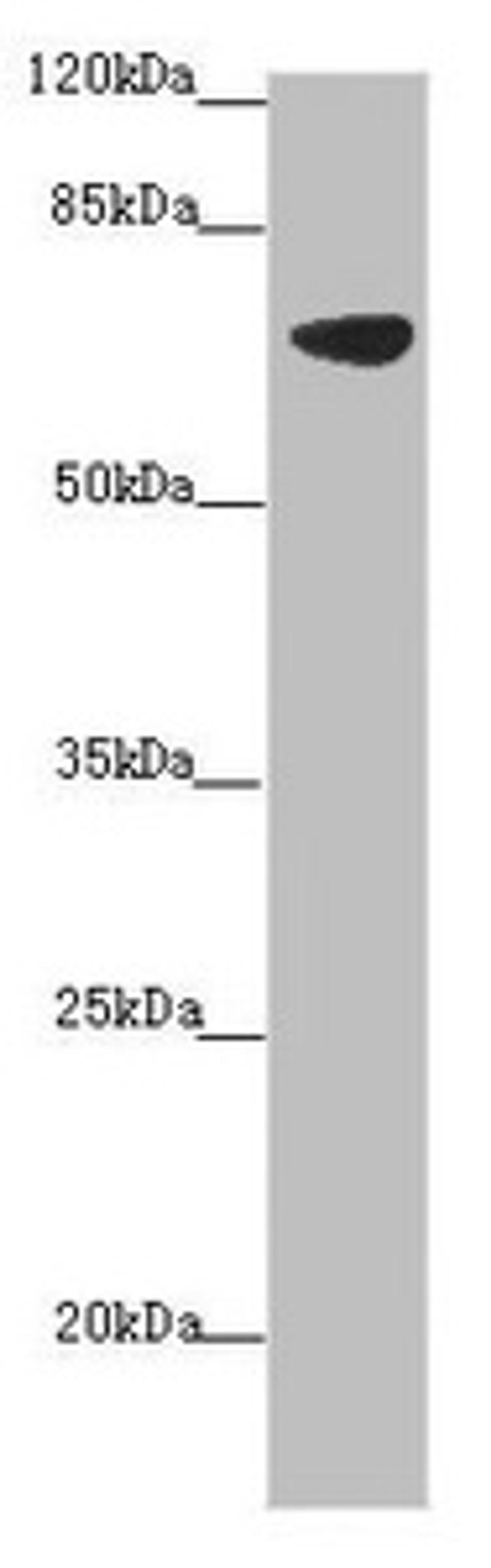 Western blot. All lanes: SLC34A1 antibody at 2.34 ug/ml + Mouse brain tissue. Secondary. Goat polyclonal to rabbit IgG at 1/10000 dilution. Predicted band size: 69, 37 kDa. Observed band size: 69 kDa. 