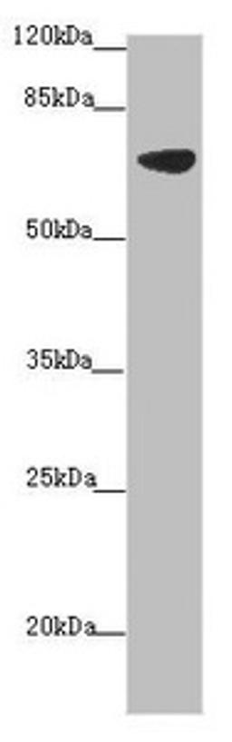 Western blot. All lanes: SLC34A1 antibody at 2.34 ug/ml + Mouse brain tissue. Secondary. Goat polyclonal to rabbit IgG at 1/10000 dilution. Predicted band size: 69, 37 kDa. Observed band size: 69 kDa. 