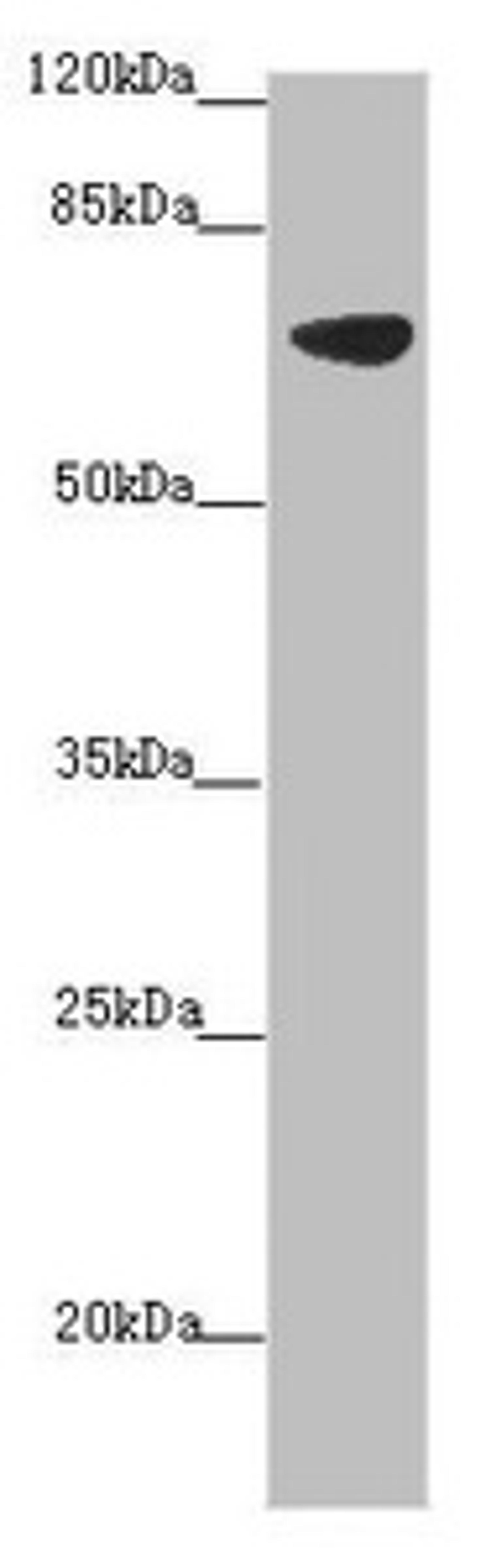 Western blot. All lanes: SLC34A1 antibody at 2.34 ug/ml + Mouse brain tissue. Secondary. Goat polyclonal to rabbit IgG at 1/10000 dilution. Predicted band size: 69, 37 kDa. Observed band size: 69 kDa. 