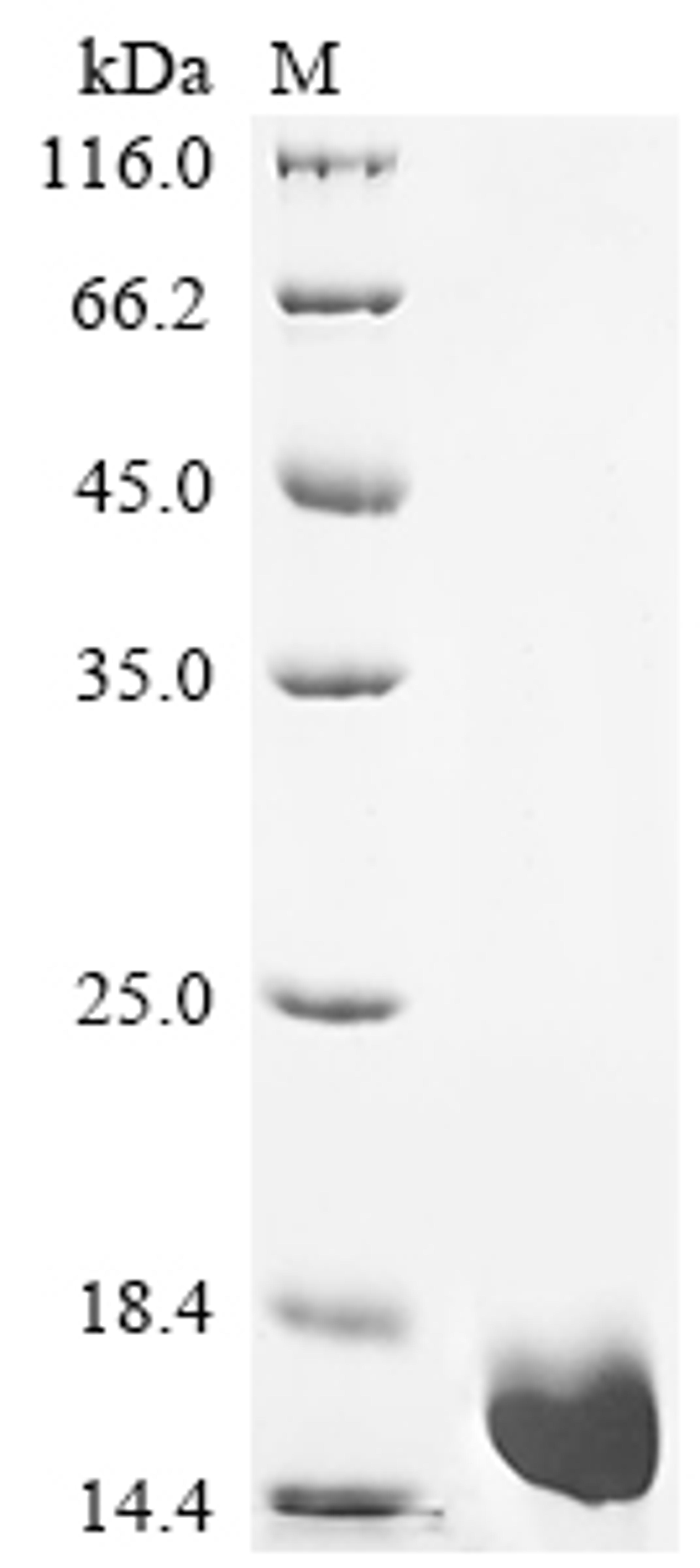 (Tris-Glycine gel) Discontinuous SDS-PAGE (reduced) with 5% enrichment gel and 15% separation gel.
