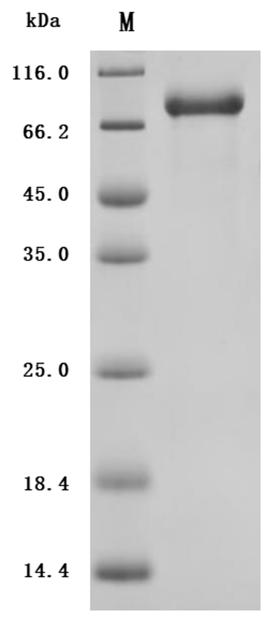 (Tris-Glycine gel) Discontinuous SDS-PAGE (reduced) with 5% enrichment gel and 15% separation gel.