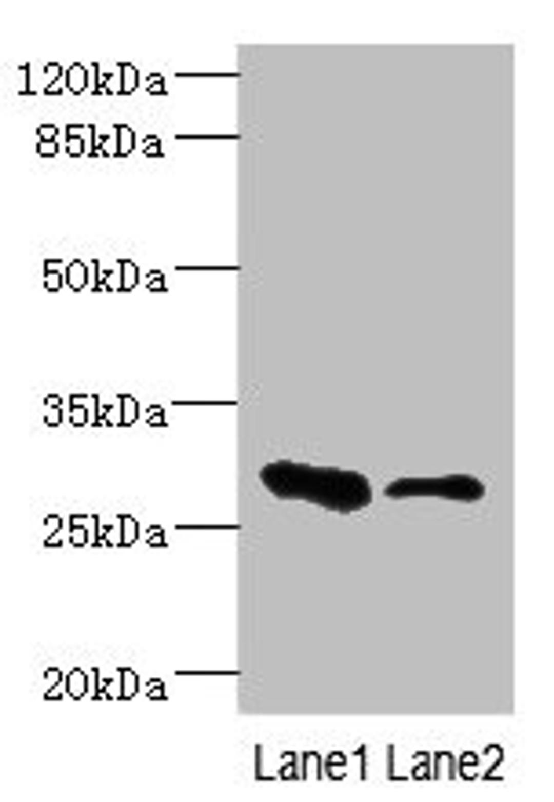Western blot. All lanes: EAF2 antibody at 3.6ug/ml. Lane 1: Rat heart tissue. Lane 2: Mouse kidney tissue. Secondary. Goat polyclonal to rabbit IgG at 1/10000 dilution. Predicted band size: 29, 15 kDa. Observed band size: 29 kDa. 