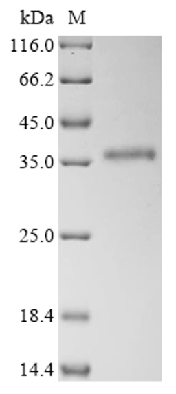 (Tris-Glycine gel) Discontinuous SDS-PAGE (reduced) with 5% enrichment gel and 15% separation gel.