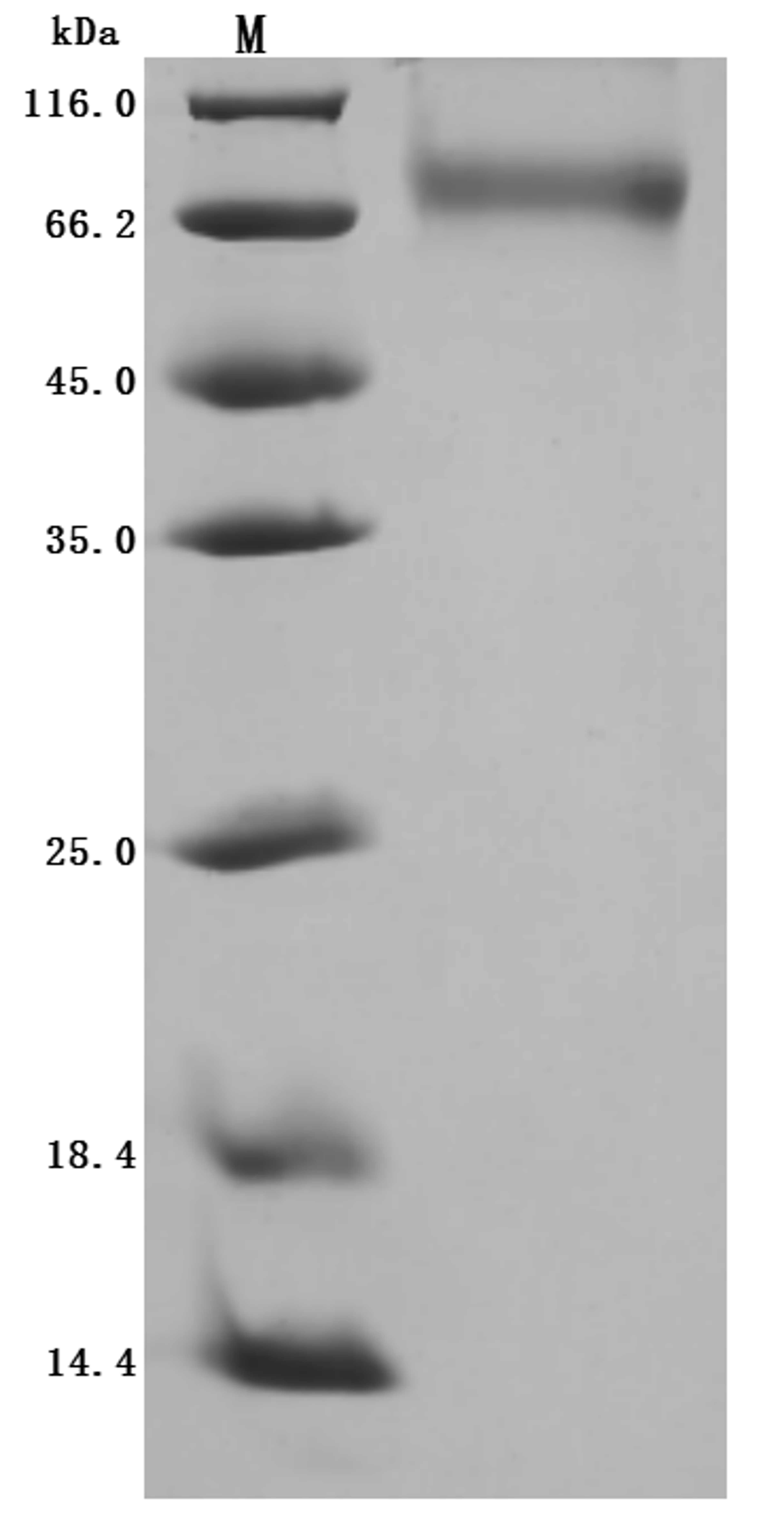 (Tris-Glycine gel) Discontinuous SDS-PAGE (reduced) with 5% enrichment gel and 15% separation gel.