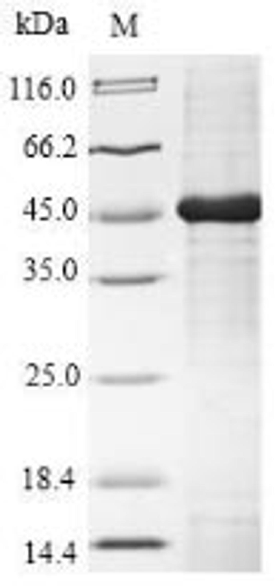 (Tris-Glycine gel) Discontinuous SDS-PAGE (reduced) with 5% enrichment gel and 15% separation gel.