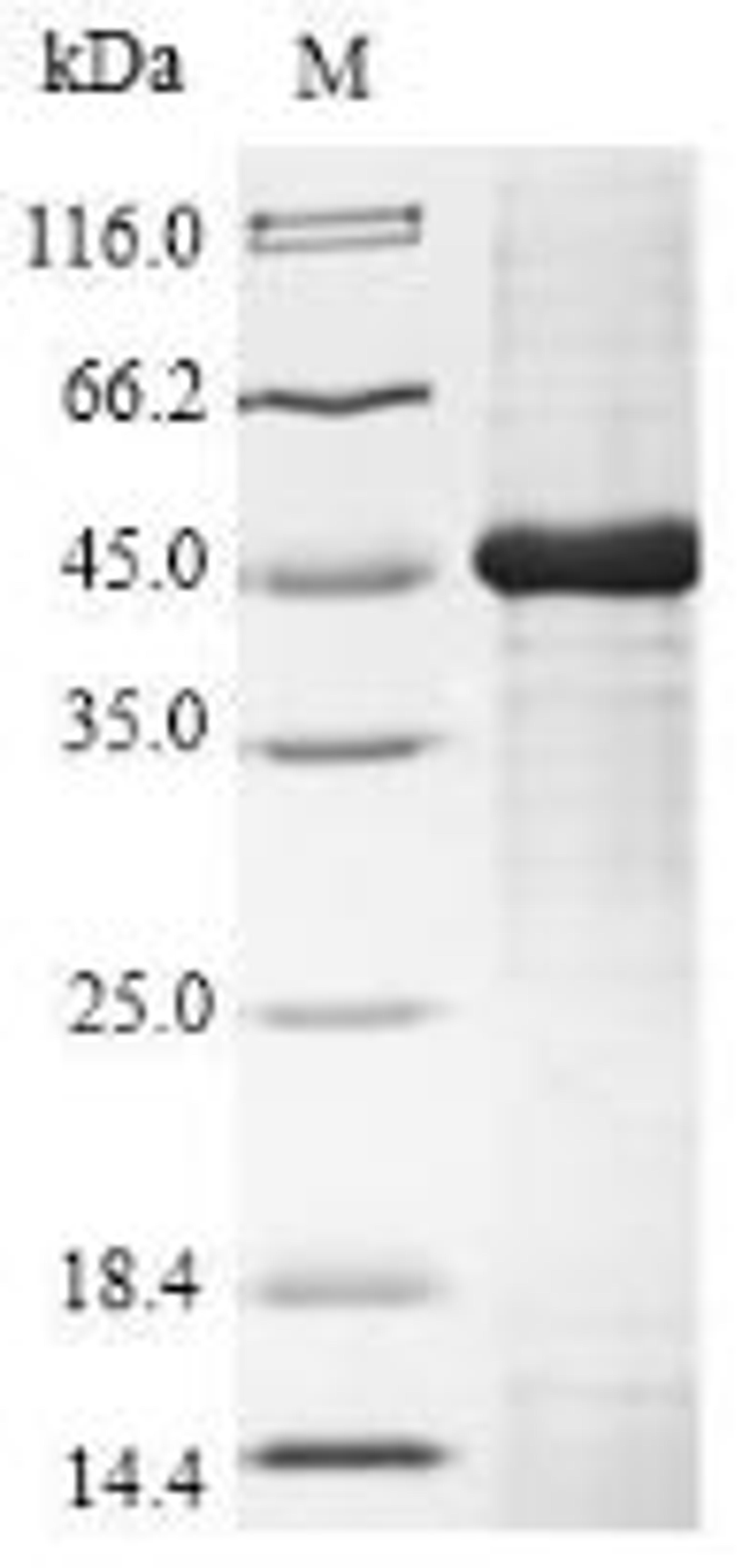 (Tris-Glycine gel) Discontinuous SDS-PAGE (reduced) with 5% enrichment gel and 15% separation gel.