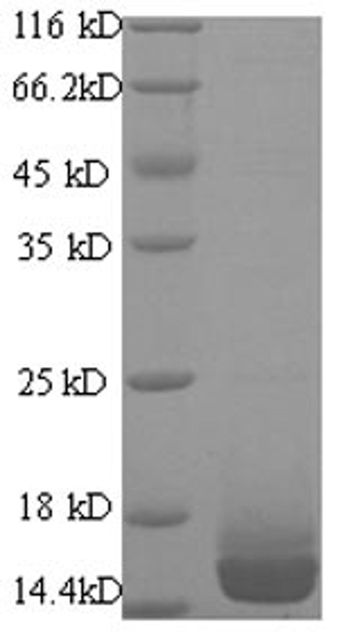 (Tris-Glycine gel) Discontinuous SDS-PAGE (reduced) with 5% enrichment gel and 15% separation gel.