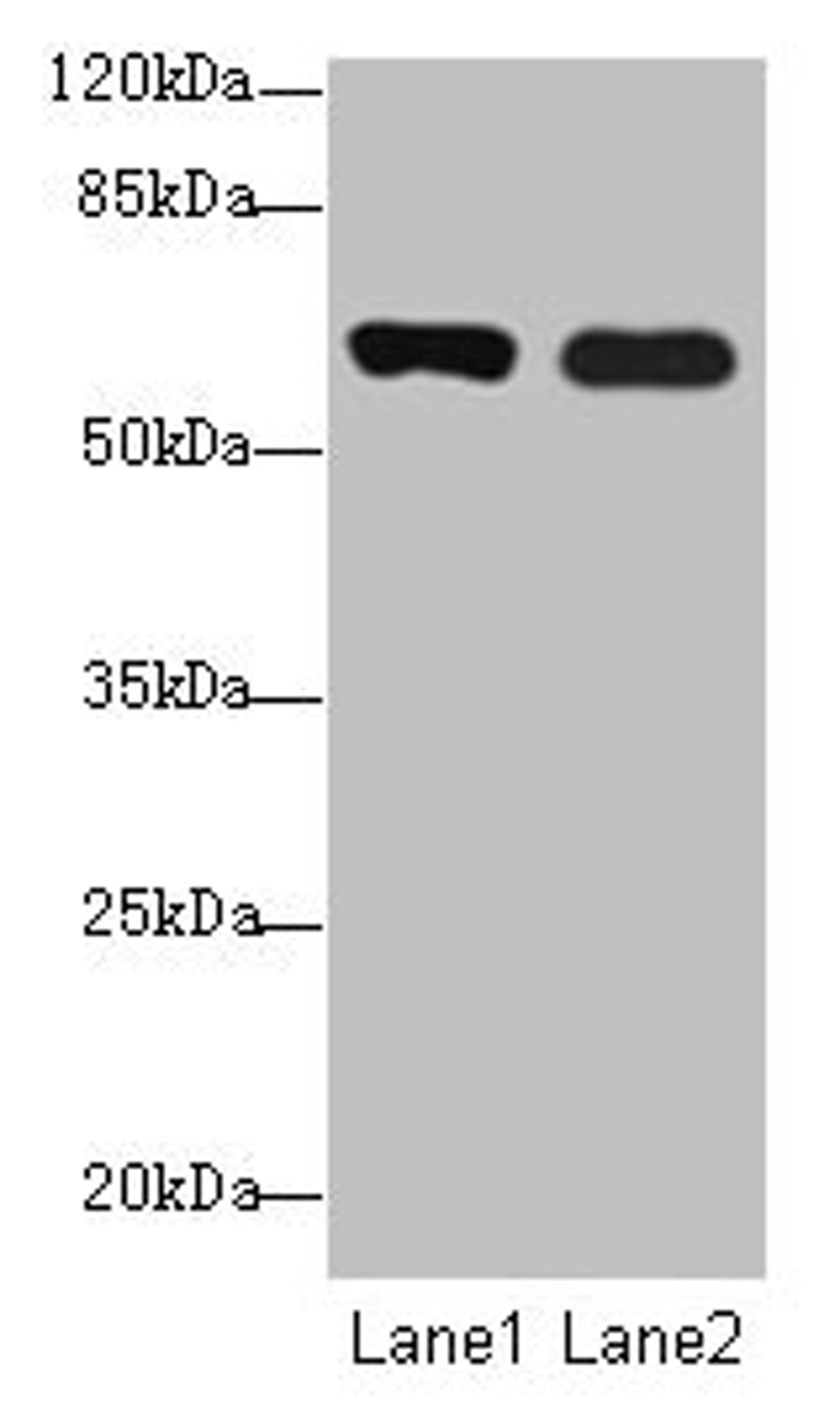 Western blot. All lanes: SPTLC3 antibody at 0.2µg/ml. Lane 1: Mouse kidney tissue. Lane 2: U87 whole cell lysate. Secondary. Goat polyclonal to rabbit IgG at 1/10000 dilution. Predicted band size: 63, 20 kDa. Observed band size: 63 kDa