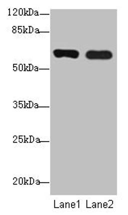 Western blot. All lanes: SPTLC3 antibody at 0.2µg/ml. Lane 1: Mouse kidney tissue. Lane 2: U87 whole cell lysate. Secondary. Goat polyclonal to rabbit IgG at 1/10000 dilution. Predicted band size: 63, 20 kDa. Observed band size: 63 kDa