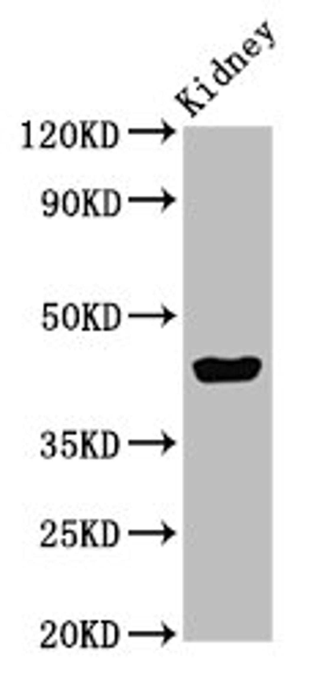 Western Blot. Positive WB detected in: Mouse kidney tissue. All lanes: EAF2 antibody at 3ug/ml. Secondary. Goat polyclonal to rabbit IgG at 1/50000 dilution. Predicted band size: 29, 15 kDa. Observed band size: 45 kDa. 