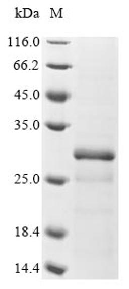 (Tris-Glycine gel) Discontinuous SDS-PAGE (reduced) with 5% enrichment gel and 15% separation gel.