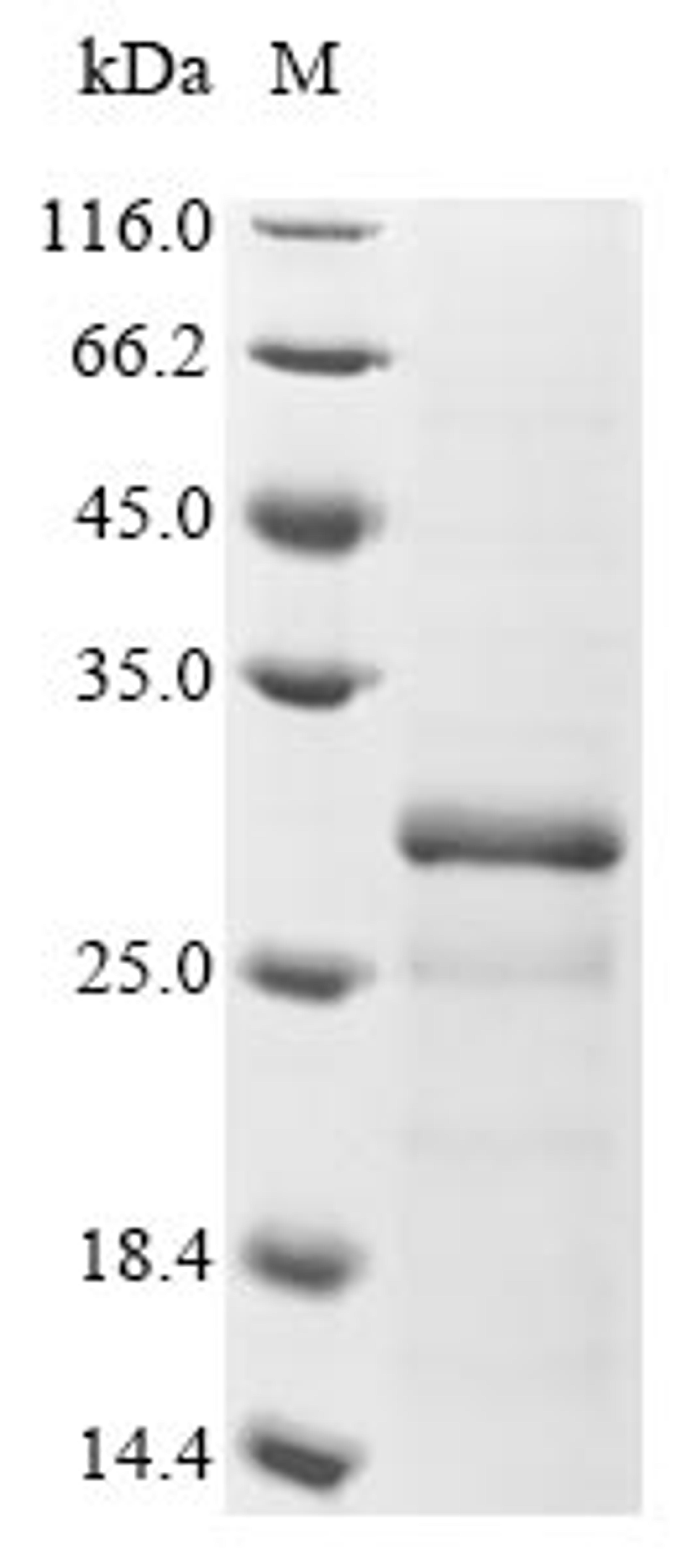 (Tris-Glycine gel) Discontinuous SDS-PAGE (reduced) with 5% enrichment gel and 15% separation gel.