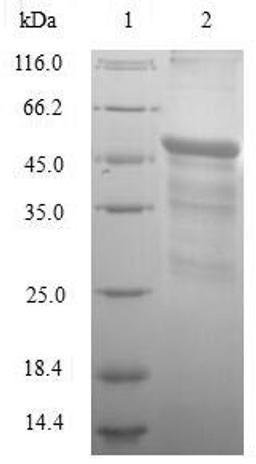 (Tris-Glycine gel) Discontinuous SDS-PAGE (reduced) with 5% enrichment gel and 15% separation gel.