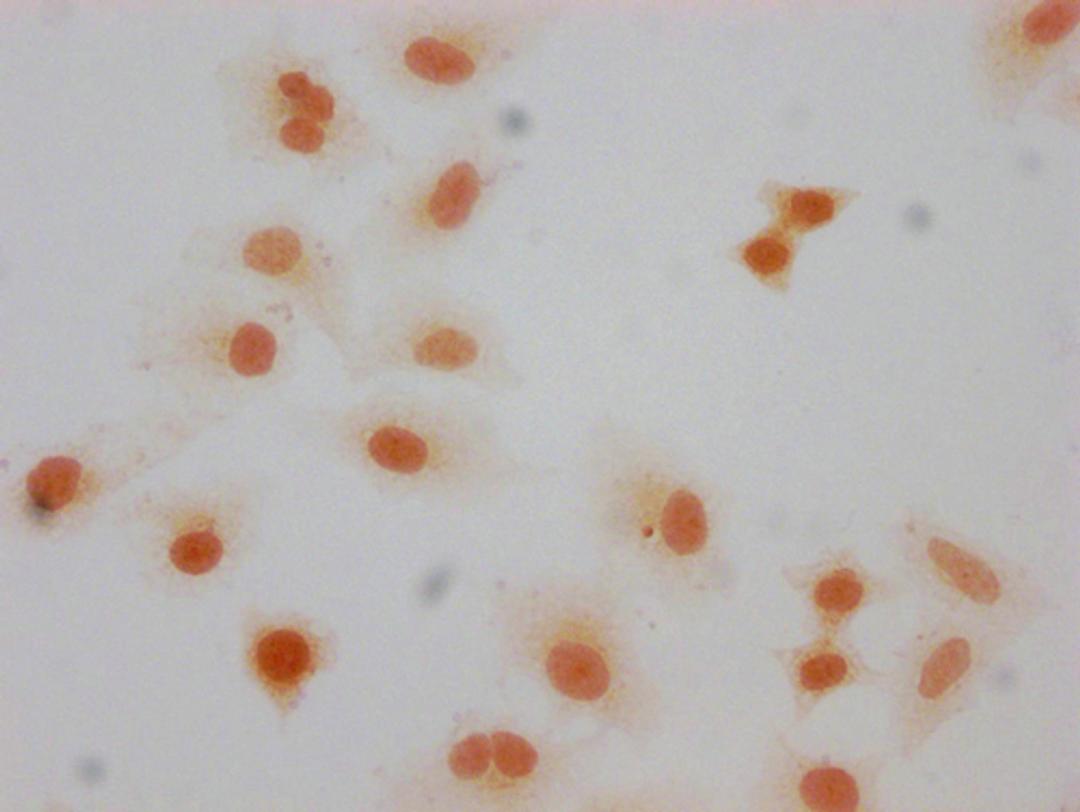 Immunocytochemistry analysis of CSB-PA010377OA66forHU diluted at 1:10 and staining in Hela cells(treated with 30mM sodium butyrate for 4h) performed on a Leica BondTM system. The cells were fixed in 4% formaldehyde, permeabilized using 0.2% Triton X-100 and blocked with 10% normal goat serum 30min at RT. Then primary antibody (1% BSA) was incubated at 4°C overnight. The primary is detected by a biotinylated secondary antibody and visualized using an HRP conjugated SP system.