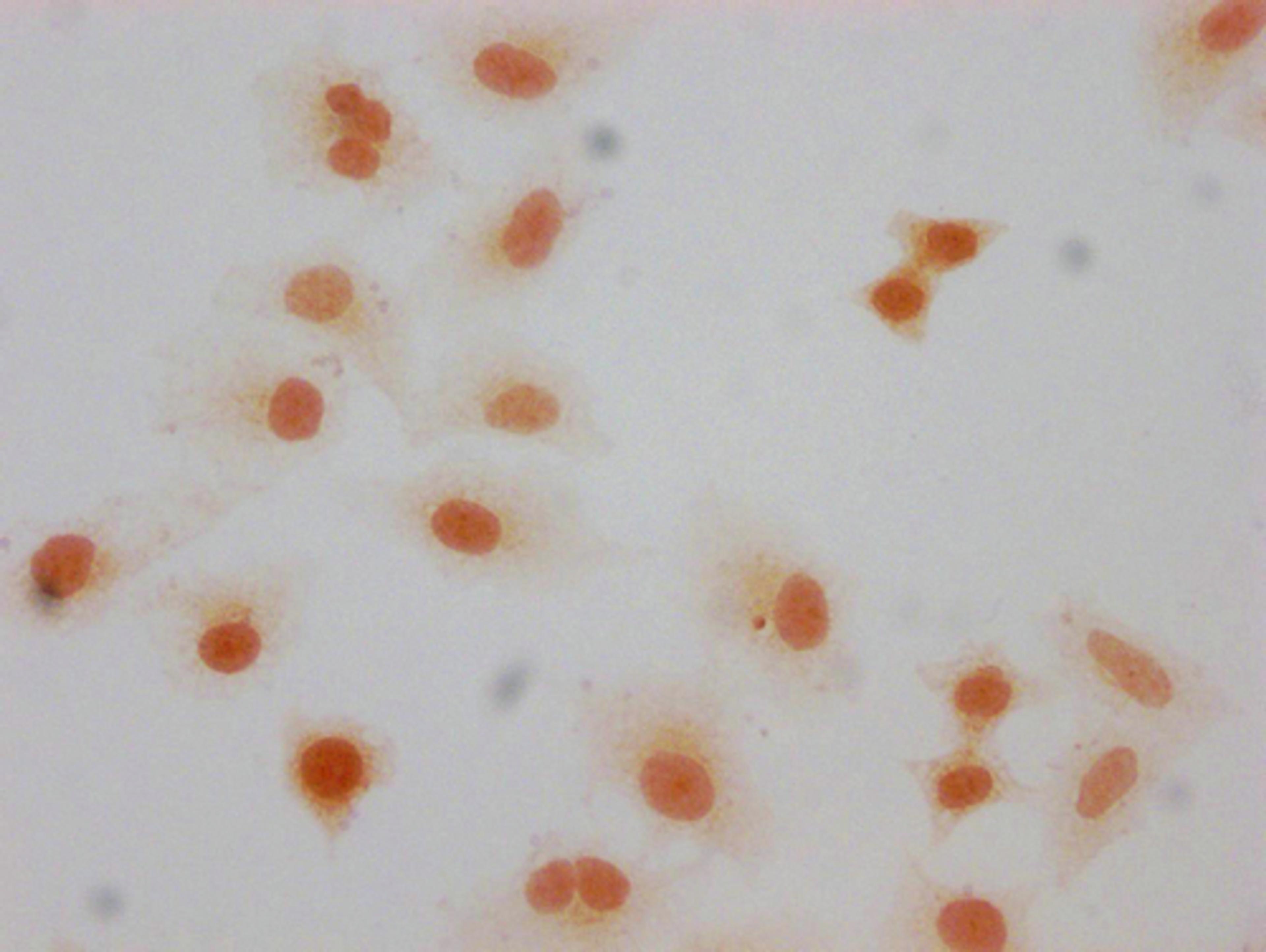 Immunocytochemistry analysis of CSB-PA010377OA66forHU diluted at 1:10 and staining in Hela cells(treated with 30mM sodium butyrate for 4h) performed on a Leica BondTM system. The cells were fixed in 4% formaldehyde, permeabilized using 0.2% Triton X-100 and blocked with 10% normal goat serum 30min at RT. Then primary antibody (1% BSA) was incubated at 4°C overnight. The primary is detected by a biotinylated secondary antibody and visualized using an HRP conjugated SP system.