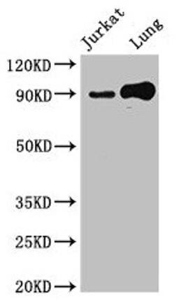 Western Blot. Positive WB detected in: Jurkat whole cell lysate, Mouse lung tissue. All lanes: STAT5B antibody at 2.4µg/ml. Secondary. Goat polyclonal to rabbit IgG at 1/50000 dilution. Predicted band size: 90 kDa. Observed band size: 90 kDa